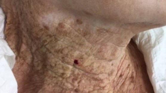 40년간 얼굴에만 선크림 발랐다…92세 할머니 피부상태 깜짝