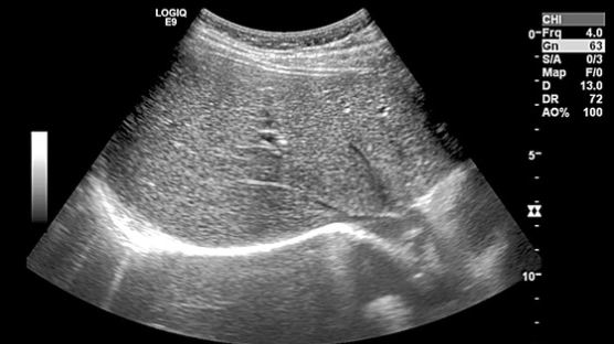 한의사 '20년 숙원' 초음파 승리했지만…더 큰 장벽 기다린다