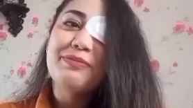 경찰이 쏜 총 눈에 맞았다…실명한 이란 양궁 국대 "후회 없어"