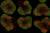 미국 UCLA 연구진이 줄기세포를 이용해 만든 신경 줄기세포(빨간색)와 피질뉴런(녹색)이 있는 미니 뇌 오가노이드 조각. [사진 UCLA]
