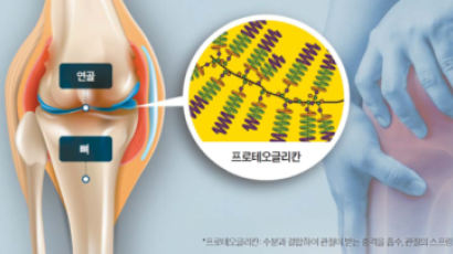 [건강한 우리집] 관절염 막으려면…연골 속 쿠션 ‘프로테오글리칸’ 채워야