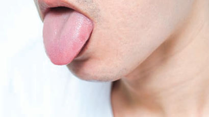 거울 보다 발견한 붉은 혀 상처…설암 위험 두배 높이는 '이것' [건강한 가족]