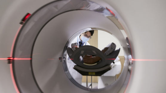 "문케어에 뇌MRI 10배 폭증"…단순 두통땐 건보 적용 안된다