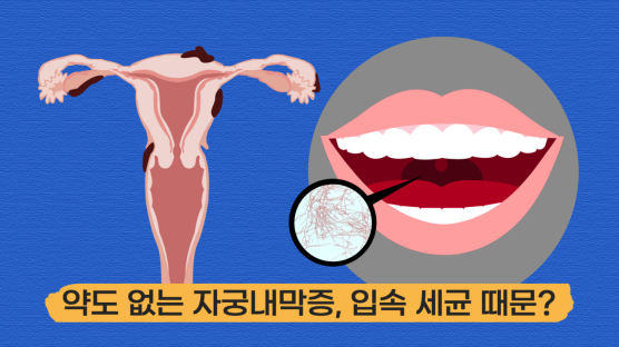 자궁 없애야 끝나는 자궁내막증…“범인은 입안에 숨어 있었다”