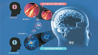 [건강한 가족] 고령화 시대 무서운 복병, 치매 위험 줄이려면 혈관 관리 필수