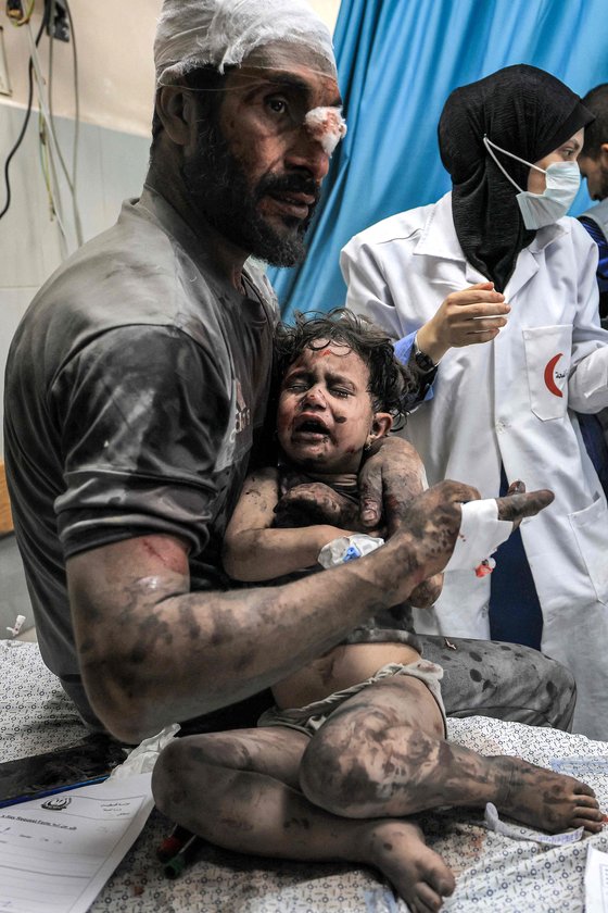 24일(현지시간) 가자 지구 남부 칸 유니스에 있는 나세르 병원 외상 병동에서 부상당한 팔레스타인인이 아이를 안고 있다. AFP=연합뉴스