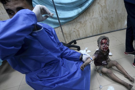 24일(현지시간) 가자지구 데이르 알발라의 한 병원에서 이스라엘의 폭격으로 부상당한 어린이를 의료진이 치료하고 있다. AP=연합뉴스