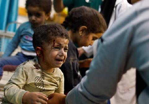 가자 병원 20곳 '완전히 멈췄다'…유엔 "사상자 집계 불가능"
