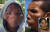 '사자 얼굴 증후군'으로 알려진 레온티아증을 앓고 있는 도미니카공화국 남매의 얼굴. 사진 더선 보도 캡처