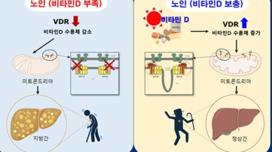 늙어서 생기는 지방간, 비타민D로 막을 수 있다…세계 첫 규명