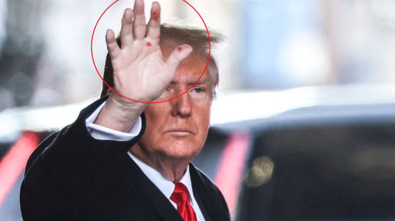 유세장·법정 오가는 트럼프…손바닥 '의문의 붉은 점' 정체