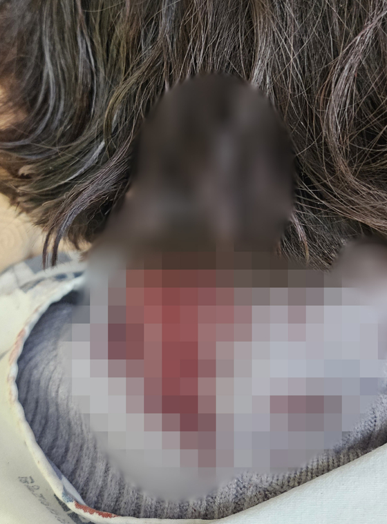 배현진 의원 피습 직후 촬영된 사진. 회색 니트의 목주변에 다량의 혈흔이 묻어 있다. 사진 배현진 의원실 