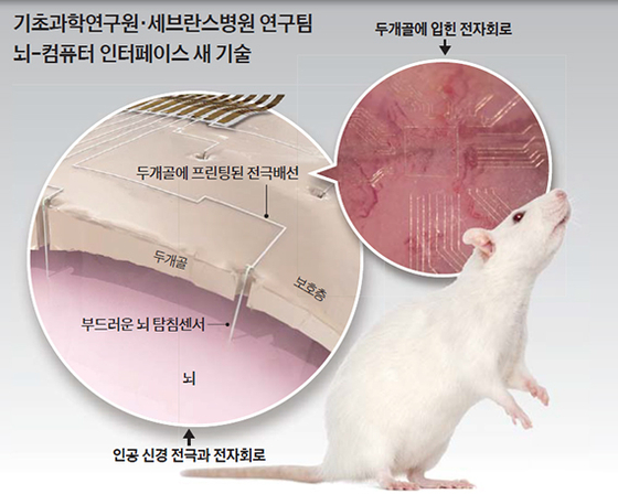 쥐 두개골에 인쇄한 전자회로…뇌질환 치료에 ‘희망 시그널’