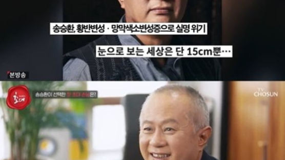 실명 위기 고백했던 송승환 "시각장애 4급, 형체만 알아봐"