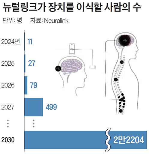 뉴럴링크가 장치를 이식할 사람의 수