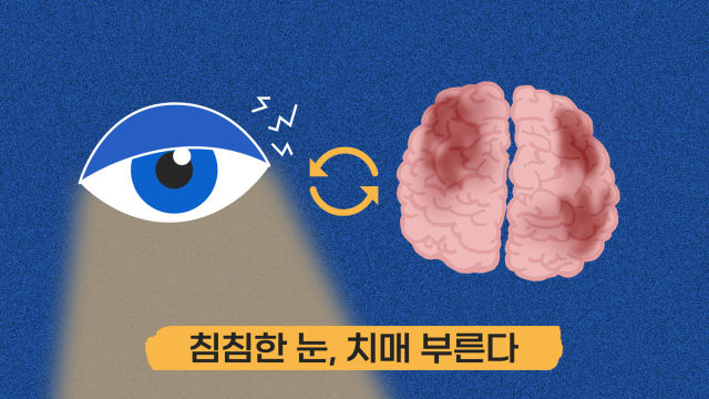 눈 침침, 백내장 진단 ‘조심’…치매 12년 전 예측하는 ‘눈’