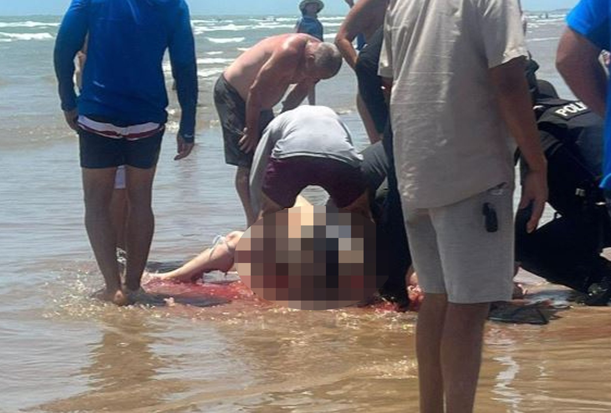순식간에 붉은 피로 물든 바다…상어 습격에 4명 부상