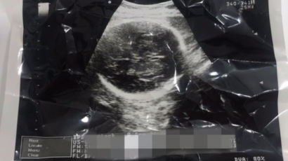 "배가 불타고 찢기는 기분"…임신 9개월 낙태 브이로그 논란