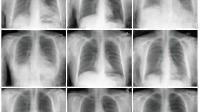 [이대승] 내 엑스레이 사진이 은밀히 유출되고 있다면?