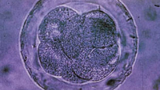 1963년 성체줄기세포 첫 발견 … 골수이식 치료 새 장