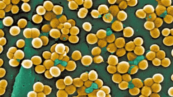 점점 독해지는 식인 박테리아 매년 7억명 감염, 50만명 사망