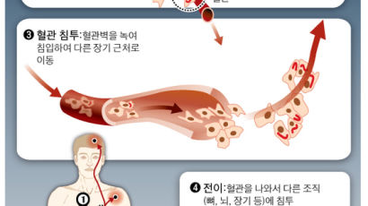 ‘이암제암’ 항암 실험…귀환병에 폭탄 심어 자폭 키스 유도
