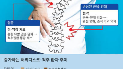 우즈 쓰러뜨렸던 허리 병, 수술보다 ‘척추 밀당’이 더 효과