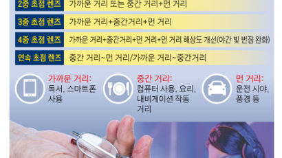 젊은층 노안 , 라식 뒤 다초점 인공수정체 수술을