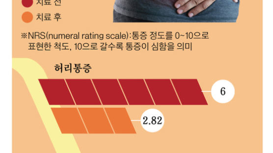 뱃살 늘면 허리디스크 유발, 식욕 당겨도 천천히 먹어야