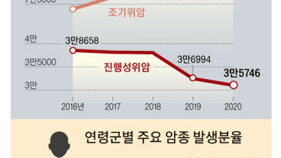 조기 위암, 진단율 높아져 수술 후 생존율 100% 가까워